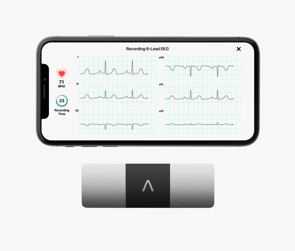 KardiaMobile 6L Personal EKG Monitor with Most Smartphones