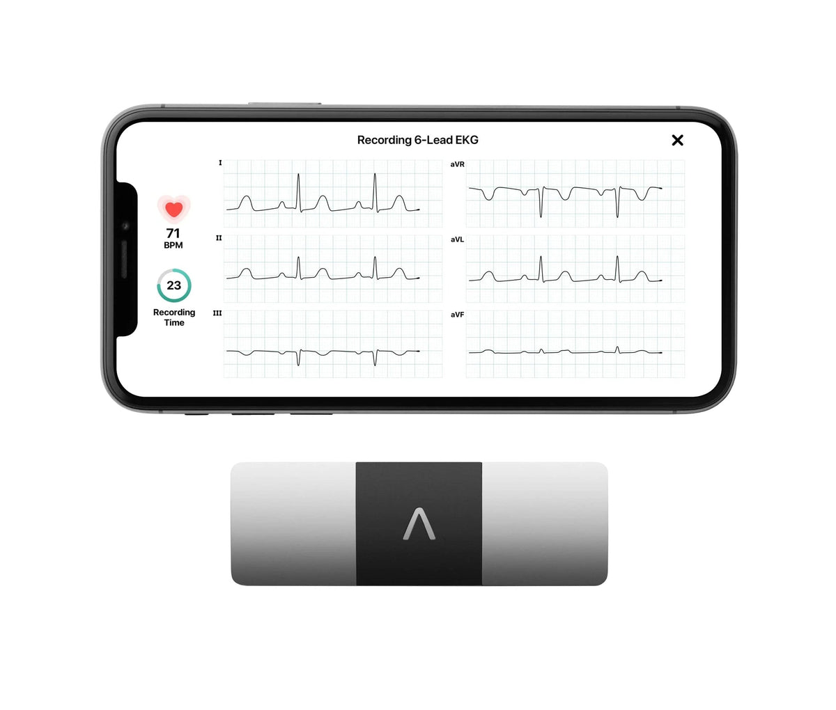 KardiaMobile 6L Personal EKG Monitor with Most Smartphones