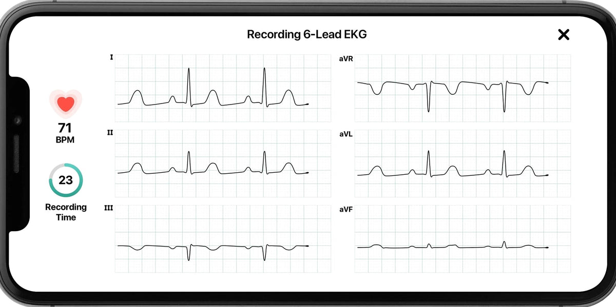 KardiaMobile 6L Personal EKG Monitor with Most Smartphones